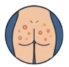 Butt Acne